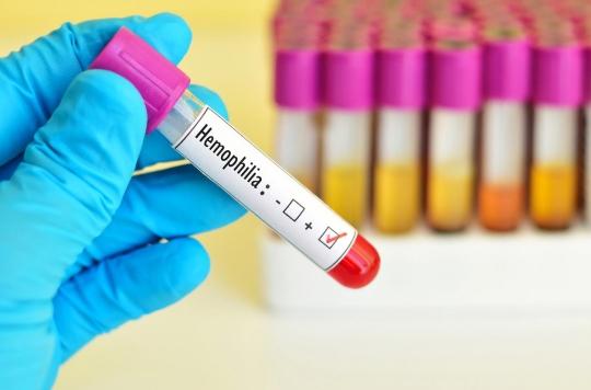 Hémophilie A : une maladie qui empêche le sang de coaguler correctement
